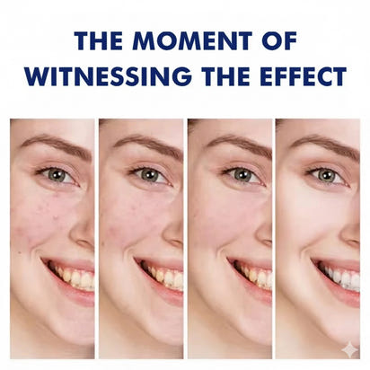 acne zero- cream and remover